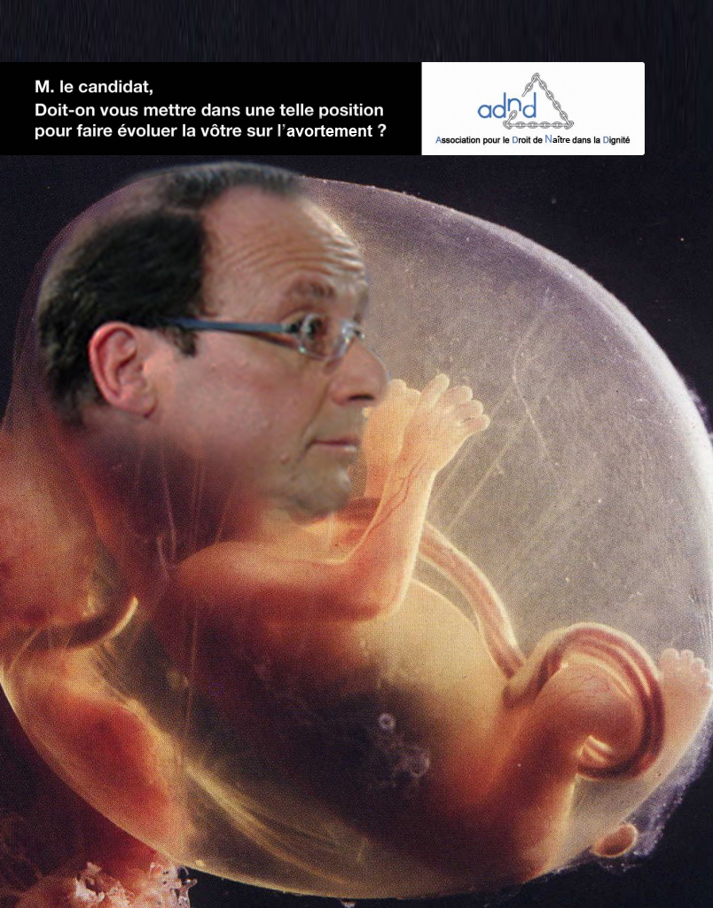 bienvenu a tous - Page 2 Hollande-foetus